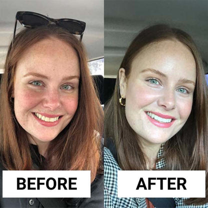 Femmie Spearmint Oil Pulling Rinse